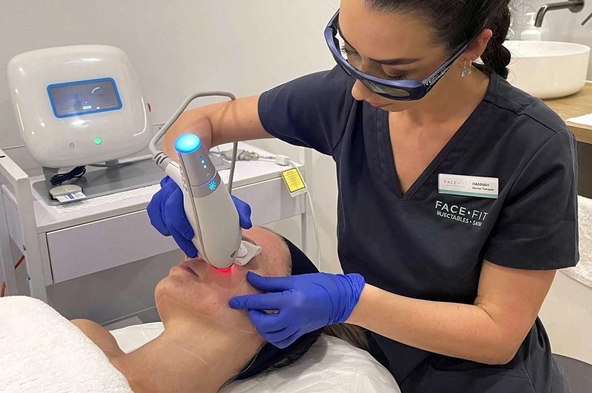Face Fit Skin specialist performing Clear + Brilliant advanced skin treatment to Gold Coast client