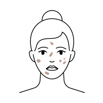 suggested products for pigmentation